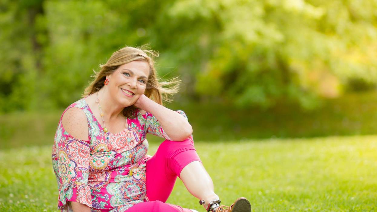 Sepsis Took My Limbs, But I Fought Hard for My Independence