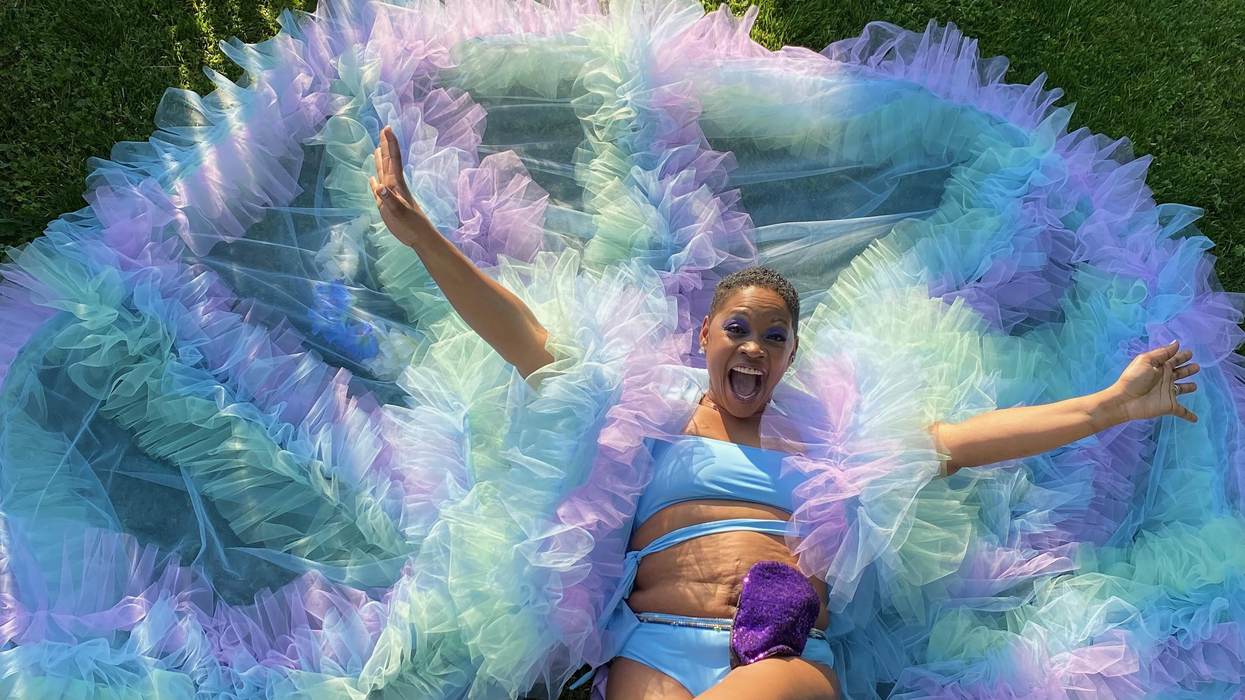 My Symptoms Were Dismissed as Hemorrhoids, but I Had Colon Cancer