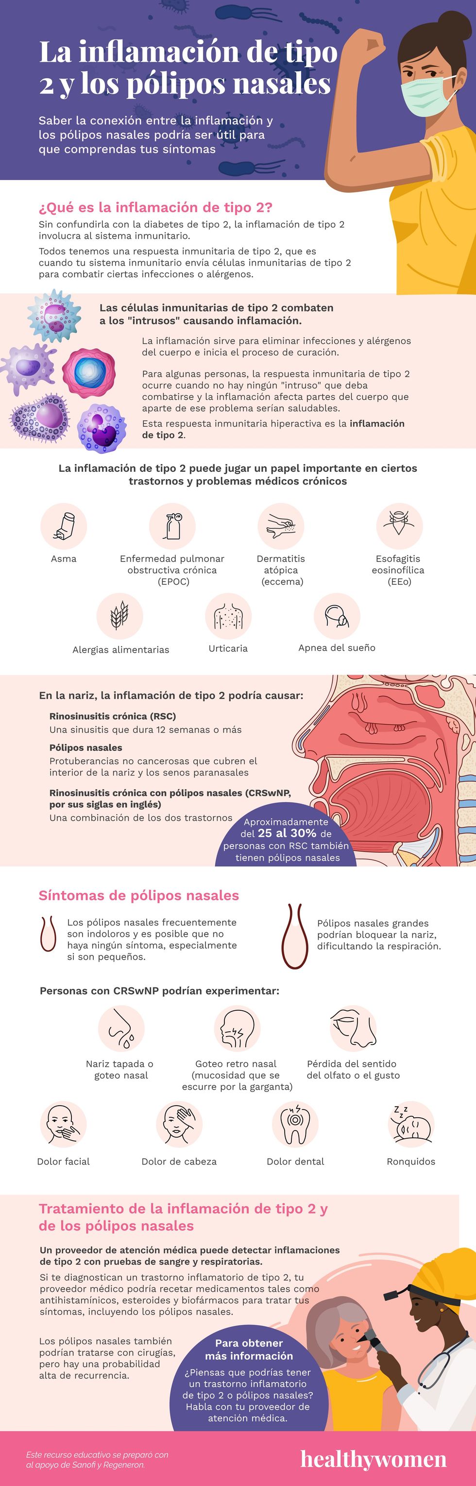 La inflamaci\u00f3n de tipo 2 y los p\u00f3lipos nasales