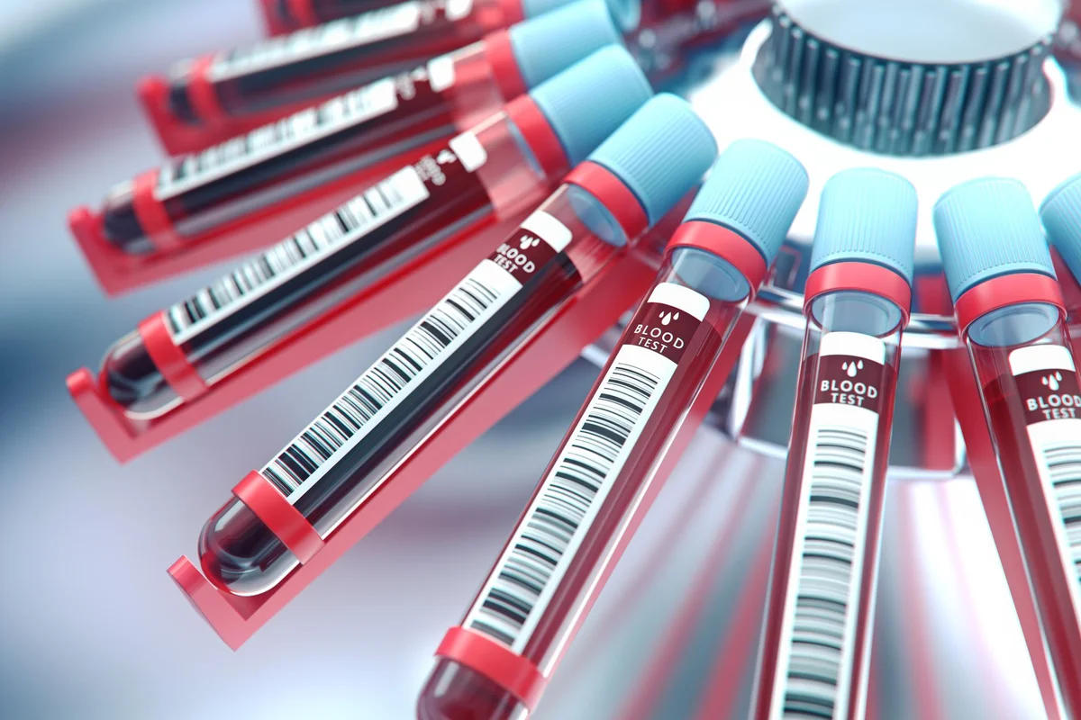 Lab equipment centrifuging blood