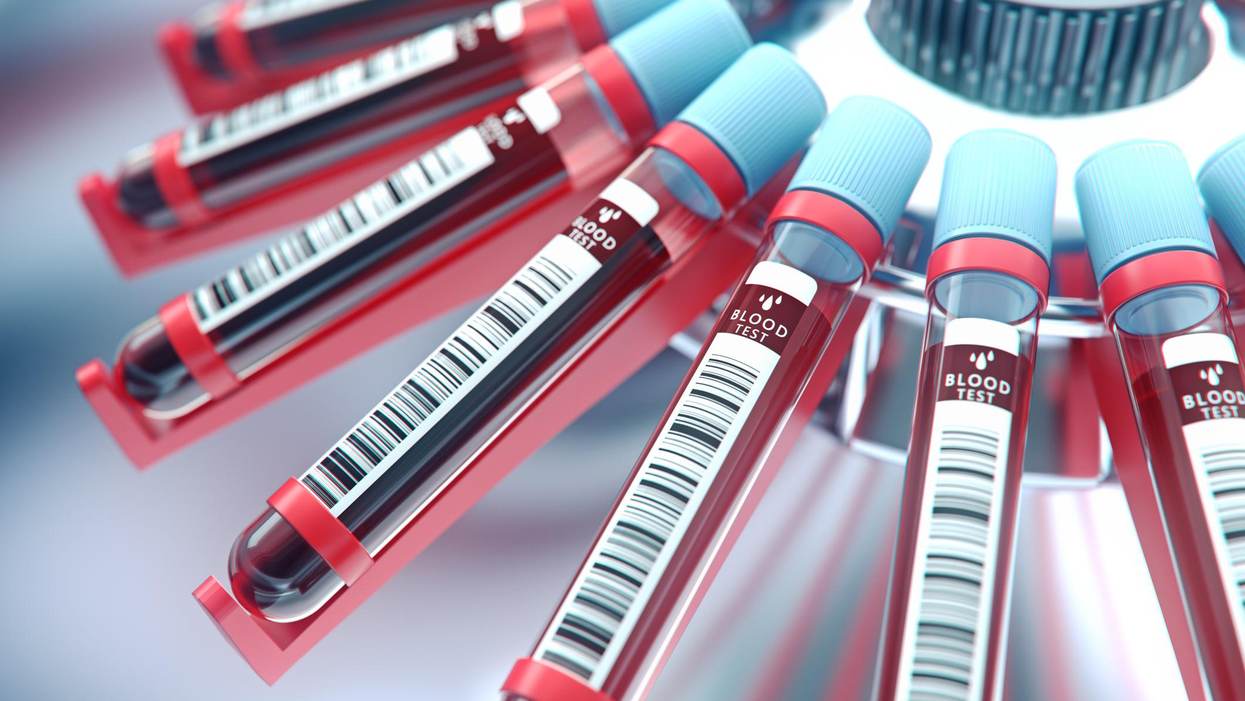 Can a Blood Test Diagnose Depression?