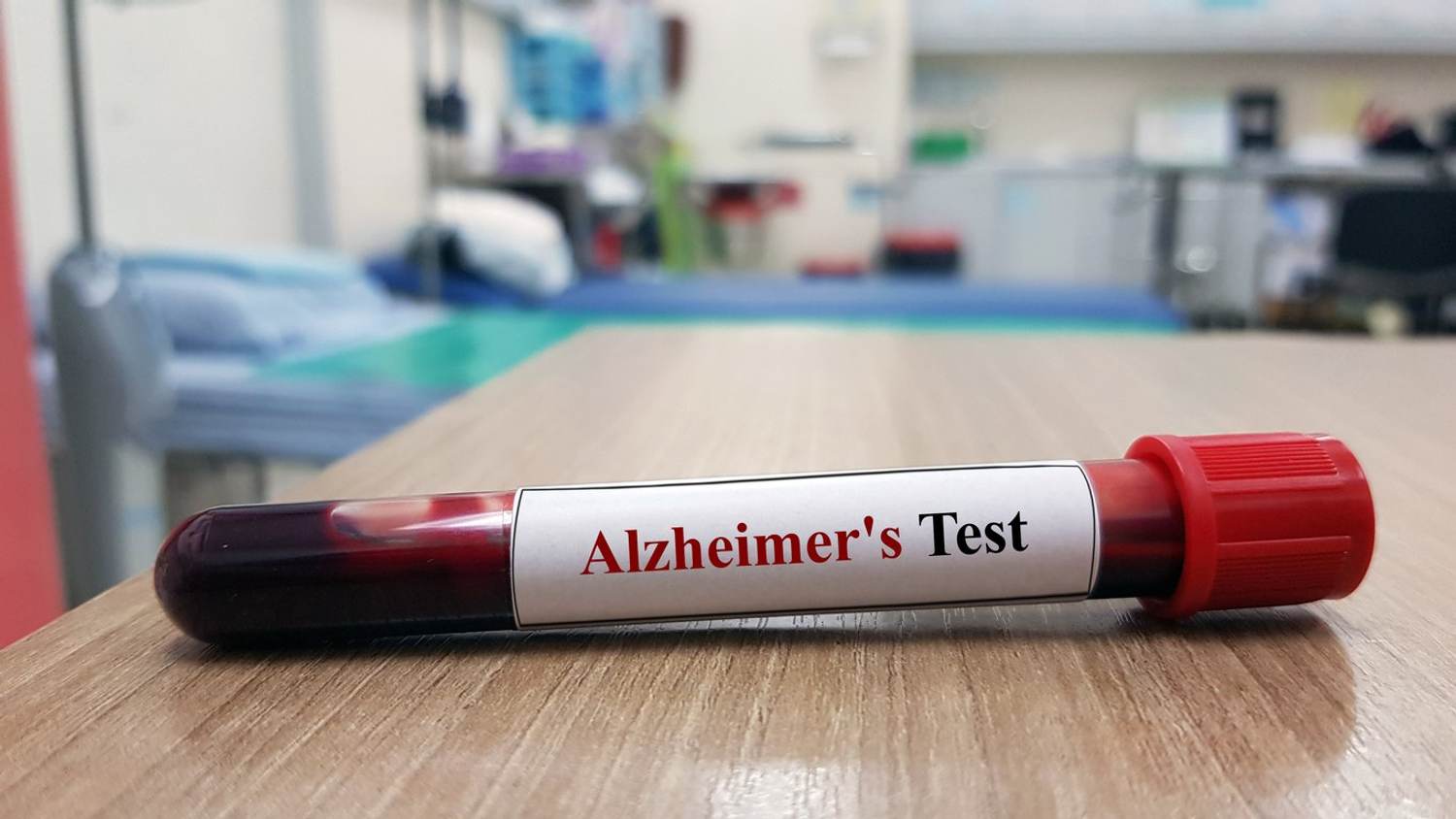 New Blood Tests for Alzheimer’s Can Help Diagnose the Disease