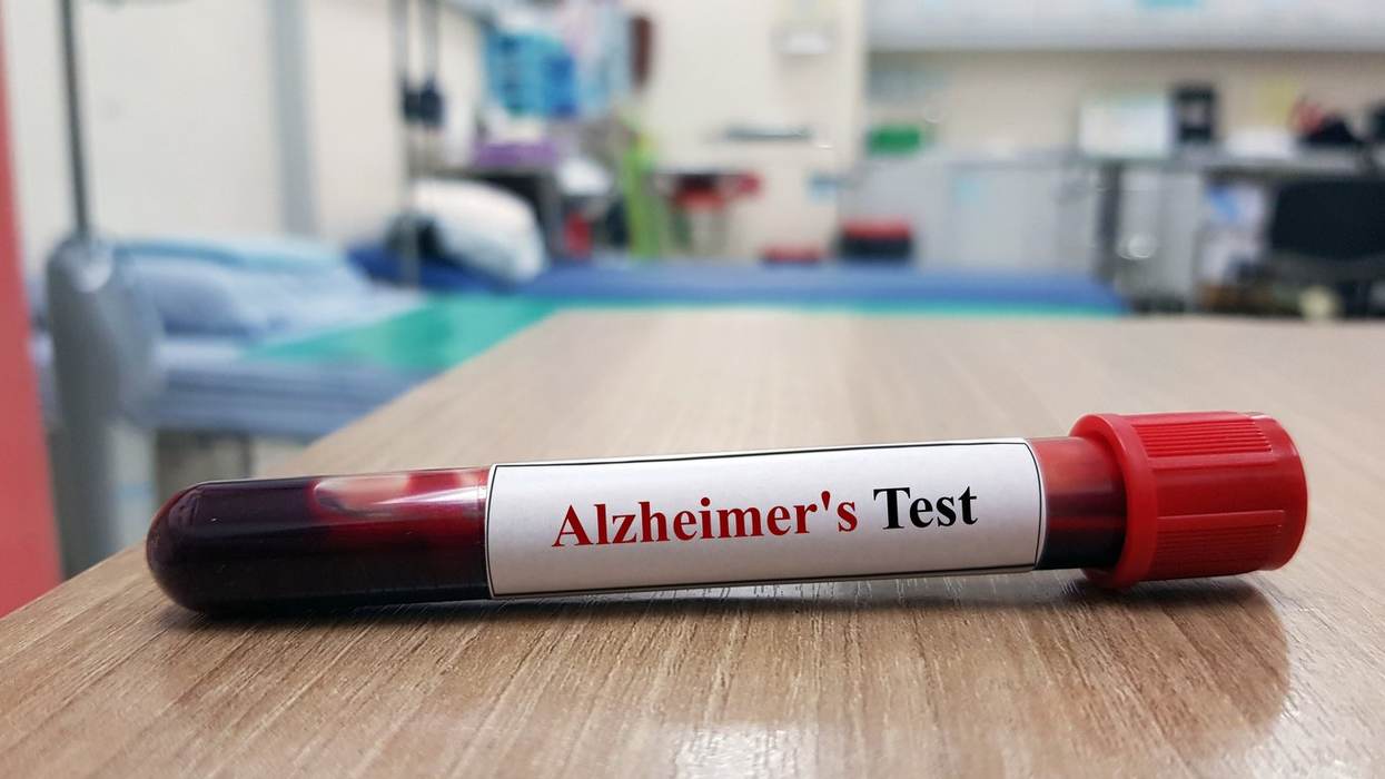 New Blood Tests for Alzheimer’s Can Help Diagnose the Disease