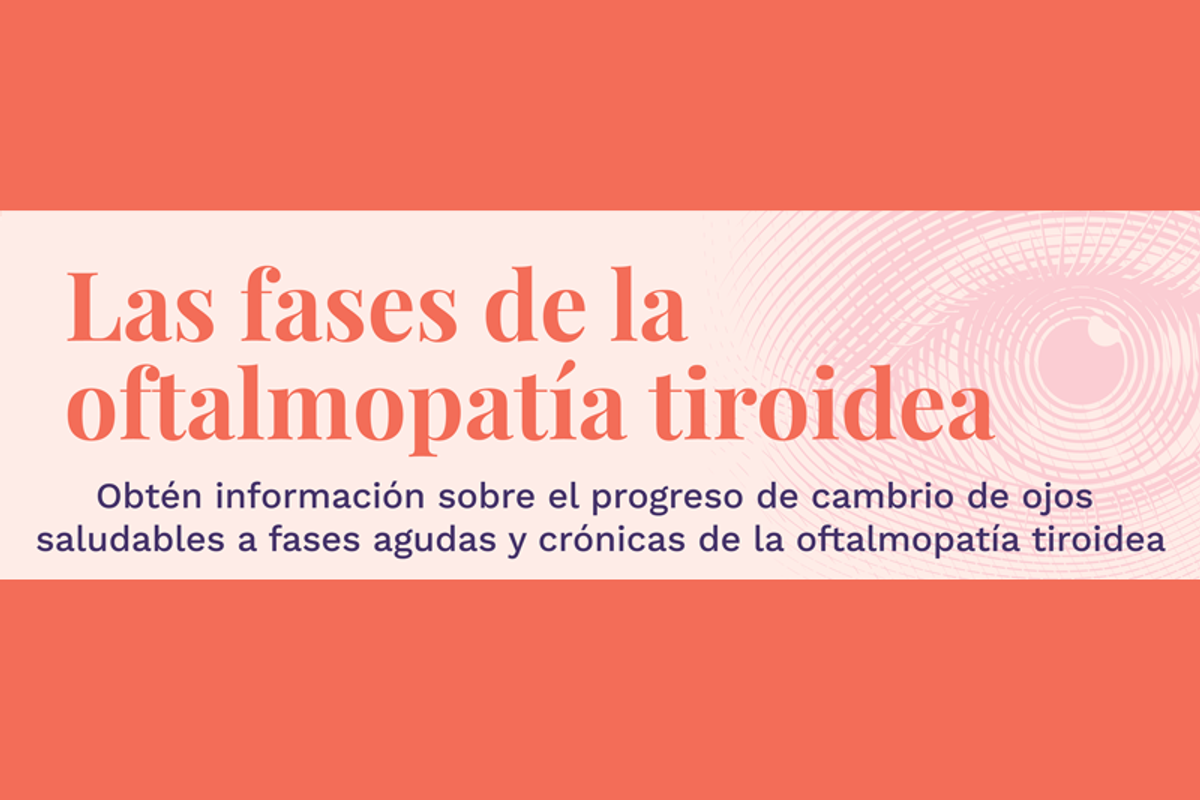 Las fases de la oftalmopatía tiroidea