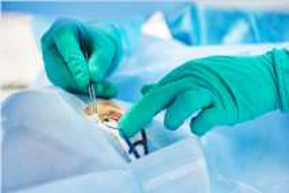 laser vision surgery