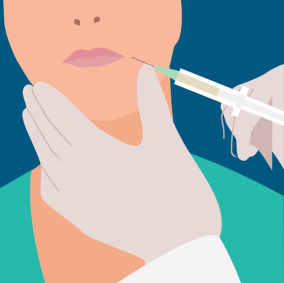 Lines and Wrinkles Be Gone!