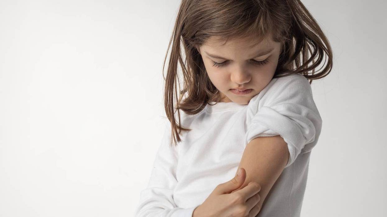 Managing Atopic Dermatitis in Kids