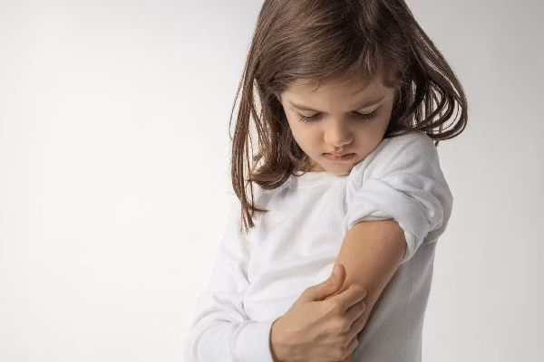 Little girl is Itching.