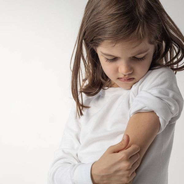 Little girl is Itching.