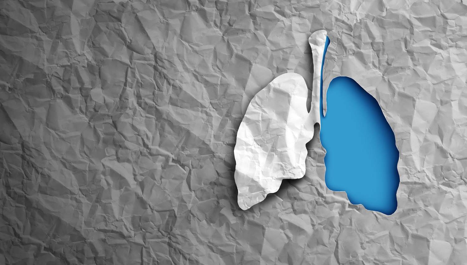 Lung Cancer Kills an Alarming Number of Women — But There’s Hope