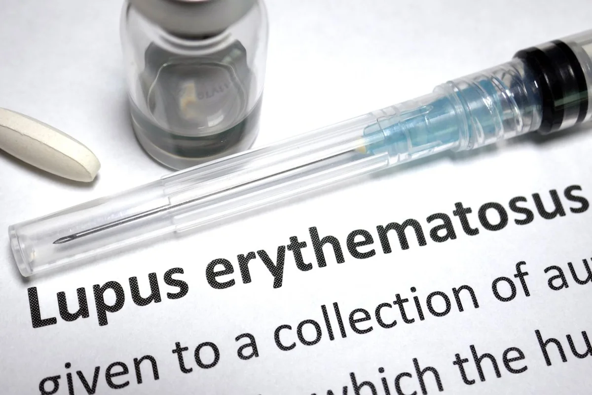 Lupus erythematous