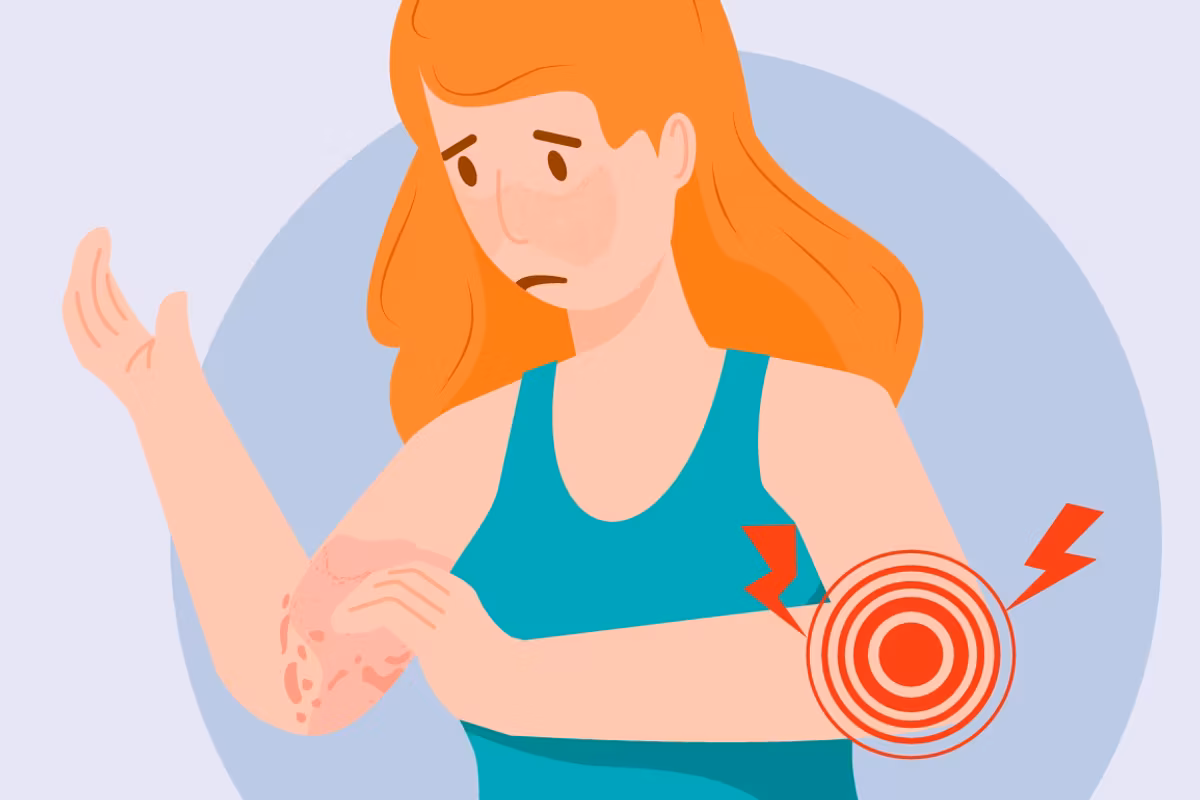 Lupus Triggers infographic