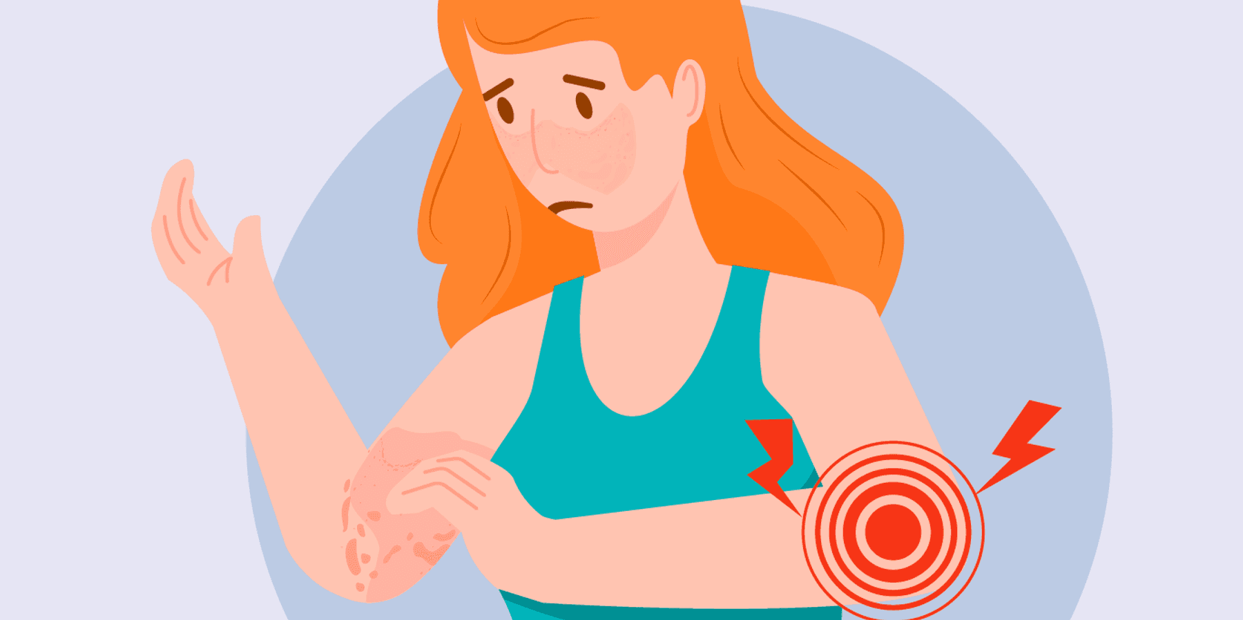 Lupus Triggers infographic