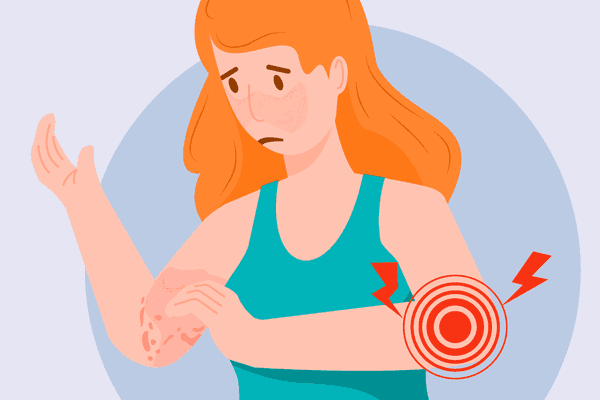 Lupus Triggers infographic
