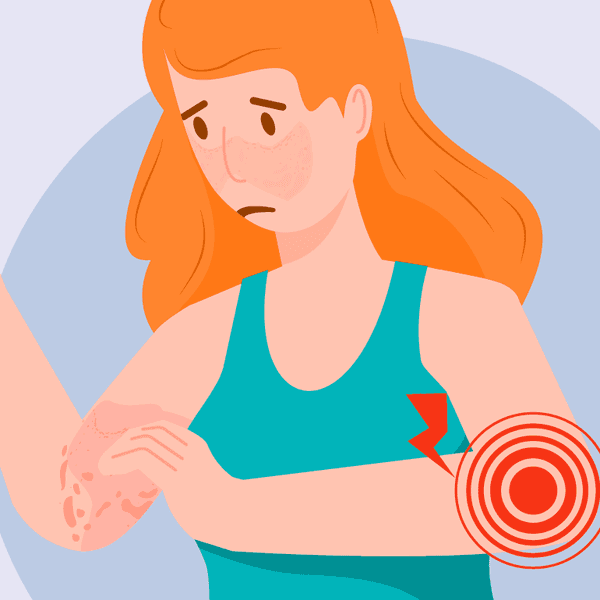 Lupus Triggers infographic