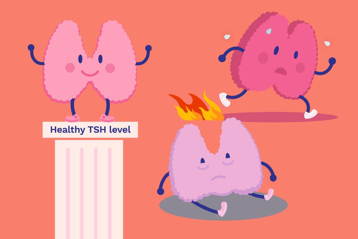 Making Sense of Your Thyroid Lab Results