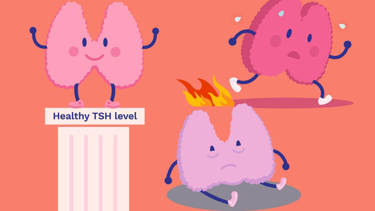 Making Sense of Your Thyroid Lab Results