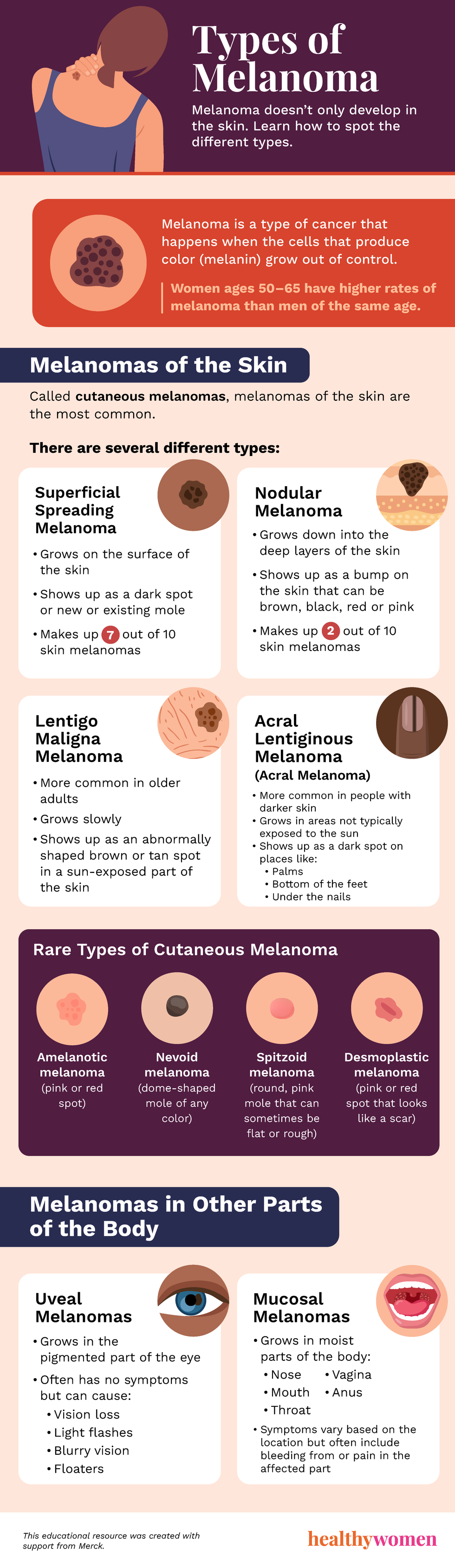 Melanoma Types infographic. Click to view PDF