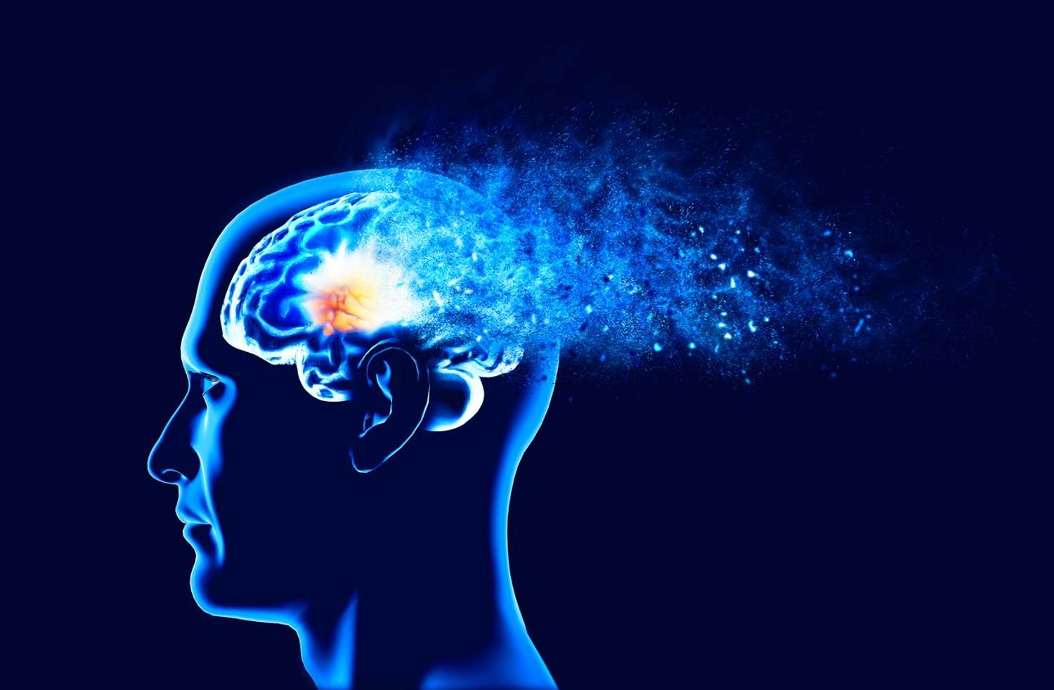 What is Alzheimer's disease?