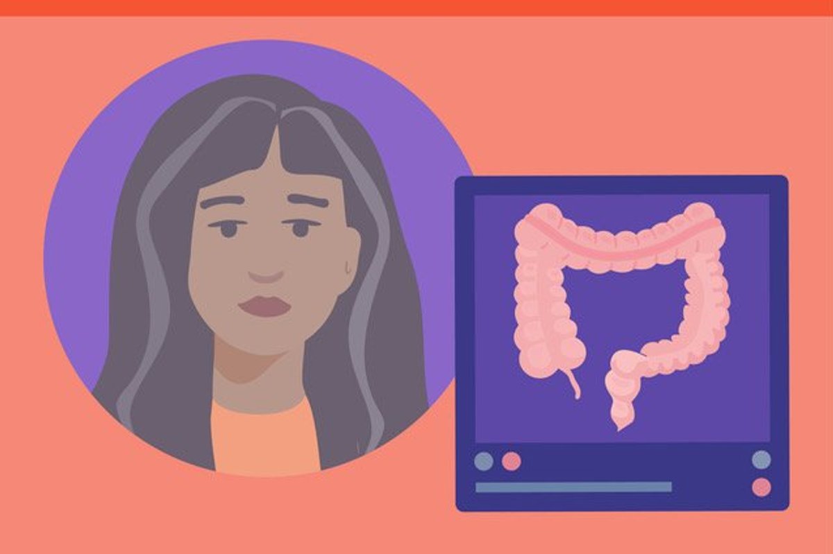 Mental Health Ups and Downs With Colon Cancer Infographic