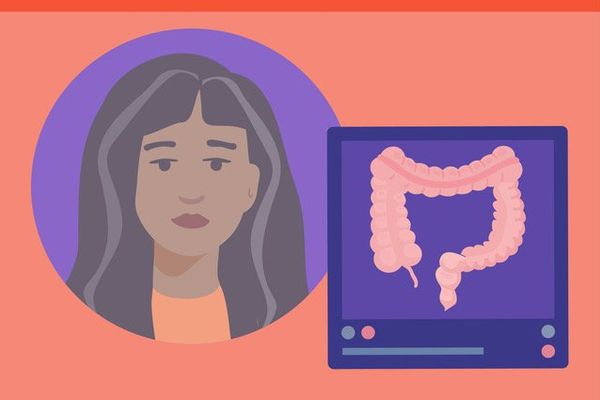 Mental Health Ups and Downs With Colon Cancer Infographic