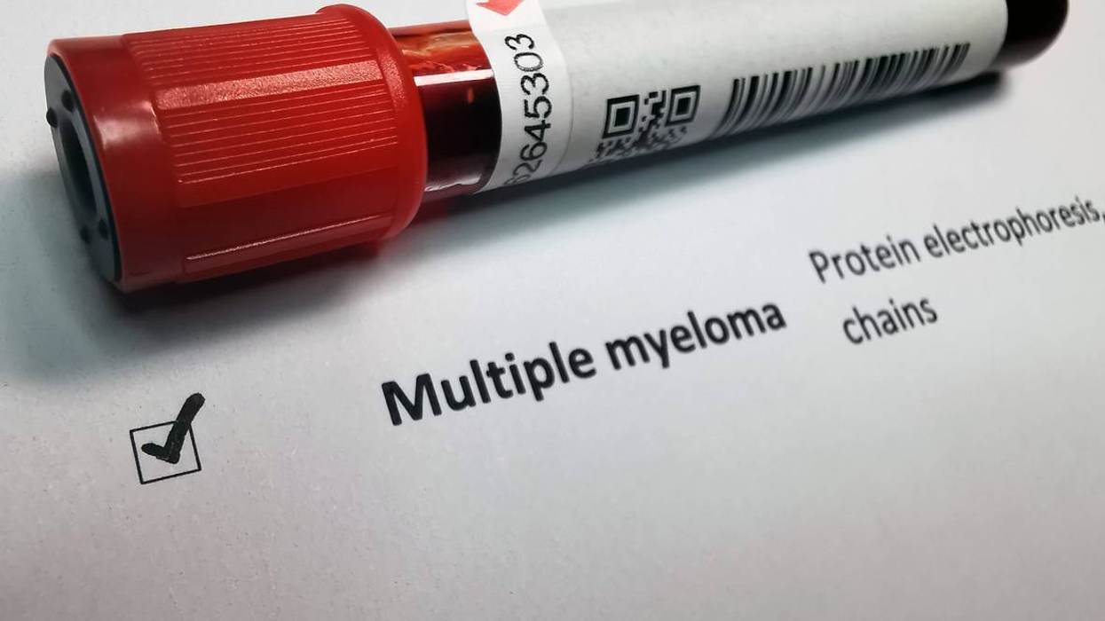 Lo que debes saber sobre el mieloma múltiple
