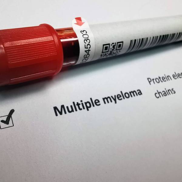 Multiple myeloma blood test