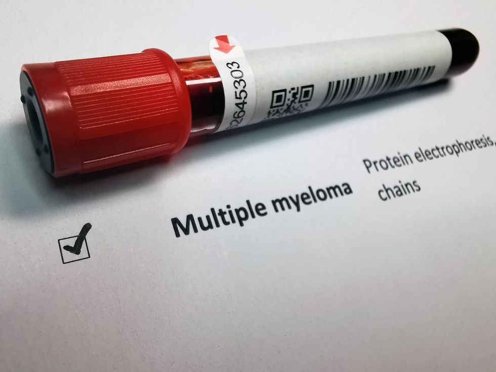 multiple myeloma blood test