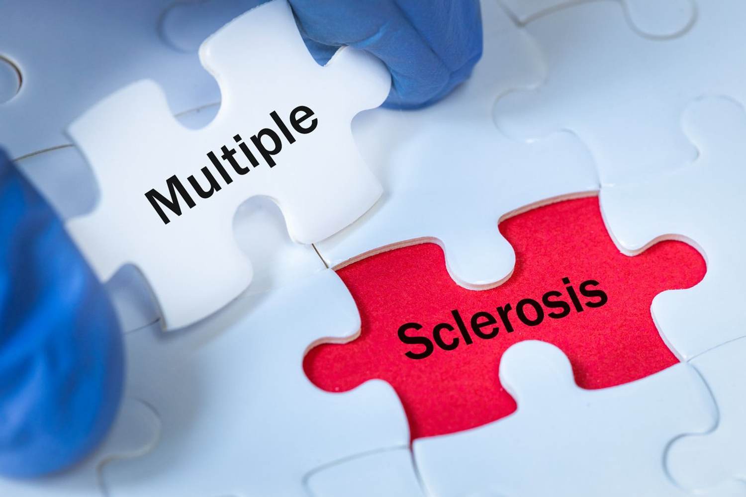 FAQs About MS