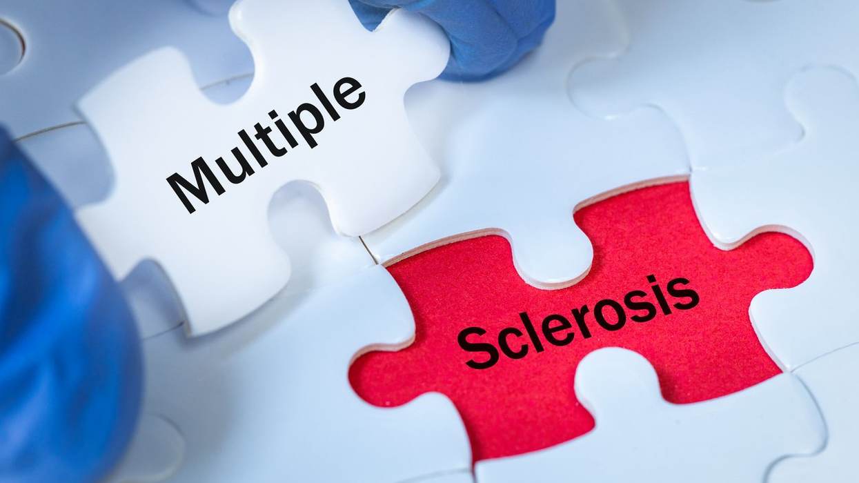 FAQs About MS