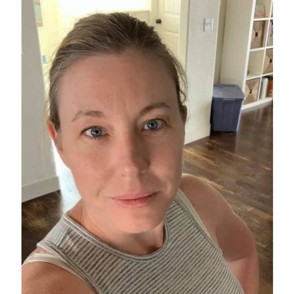 My Large Breasts Used to Hold Me Back: How I\u2019m Loving Life After My Breast Reduction