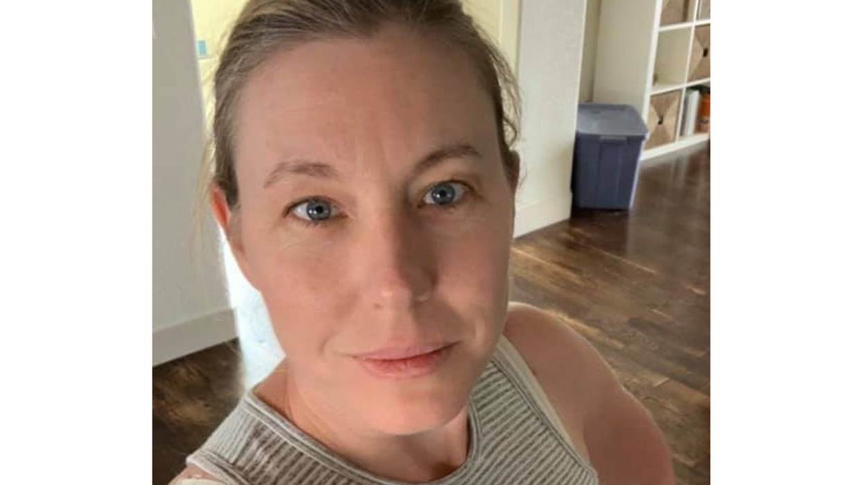 My Large Breasts Used to Hold Me Back: How I’m Loving Life After My Breast Reduction
