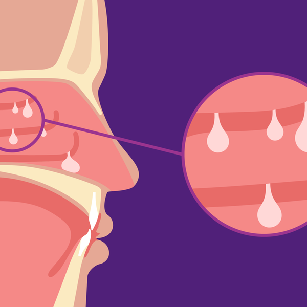 Nasal Polyps and Coexisting Conditions