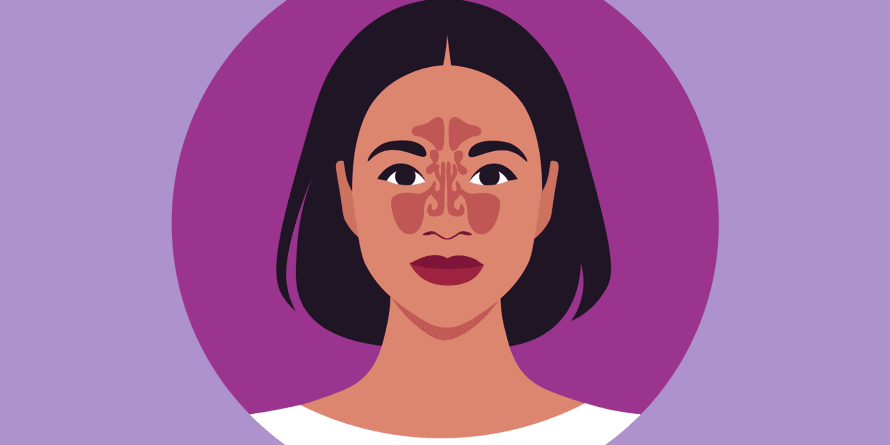 Navigating Health Insurance for Nasal Polyps Infographic