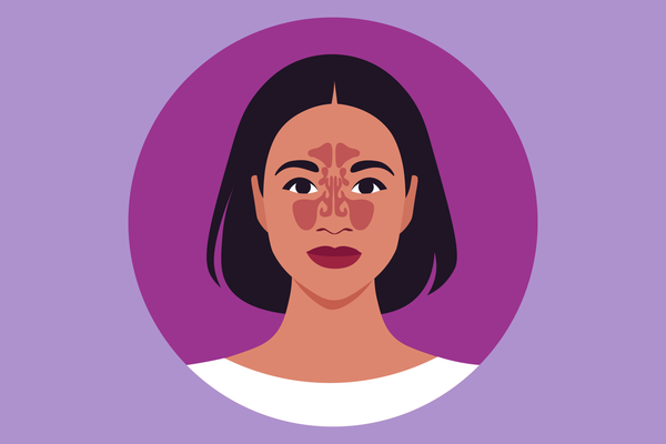 Navigating Health Insurance for Nasal Polyps Infographic