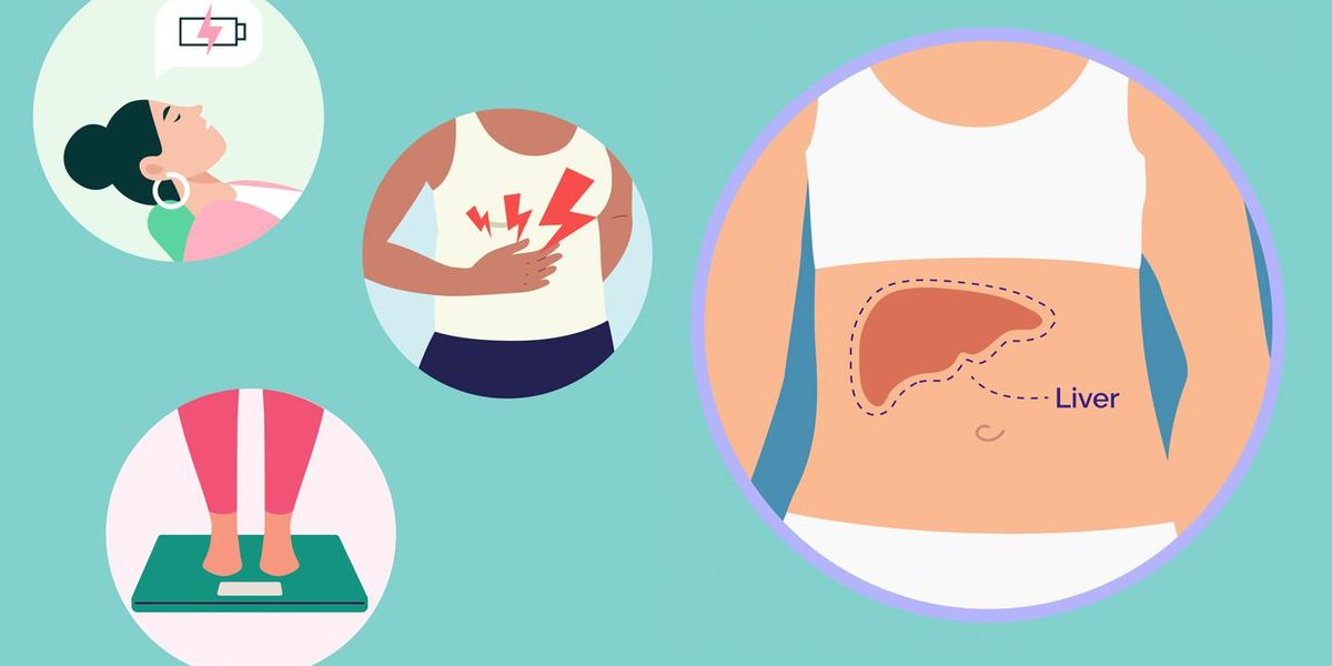 Non-Alcoholic Fatty Liver Disease image of liver and symptoms