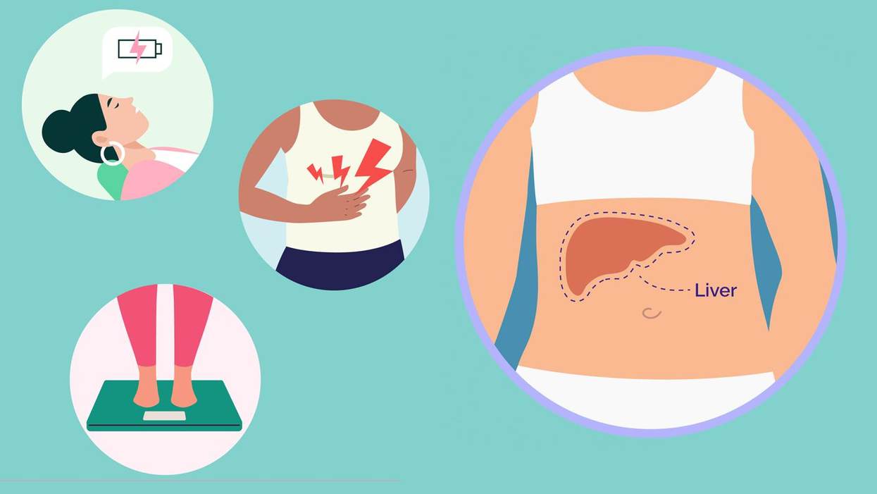 Non-Alcoholic Fatty Liver Disease