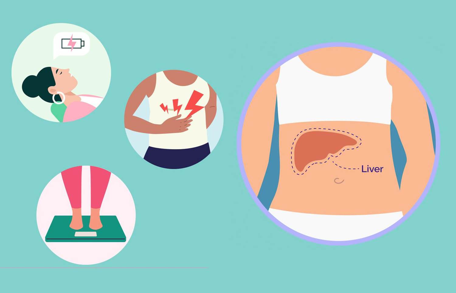 Non-Alcoholic Fatty Liver Disease