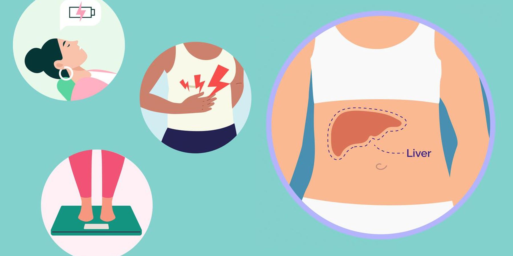 Non-Alcoholic Fatty Liver Disease image of liver and symptoms