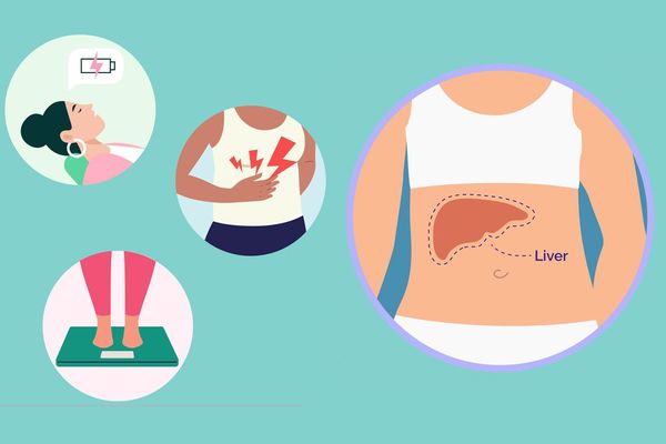 Non-Alcoholic Fatty Liver Disease image of liver and symptoms