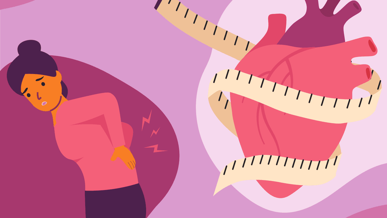 Obesity and Other Health Conditions
