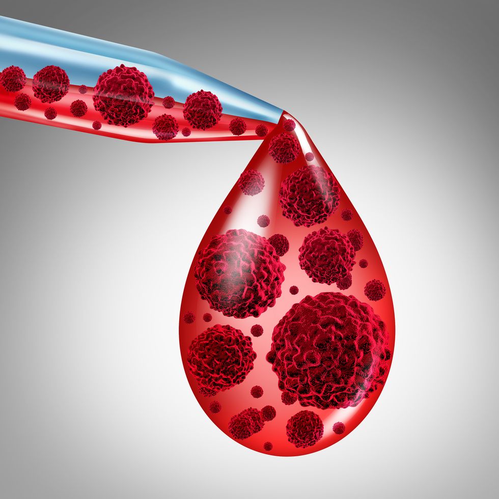 'One-Stop' Blood Test for Cancer Shows Early Promise
