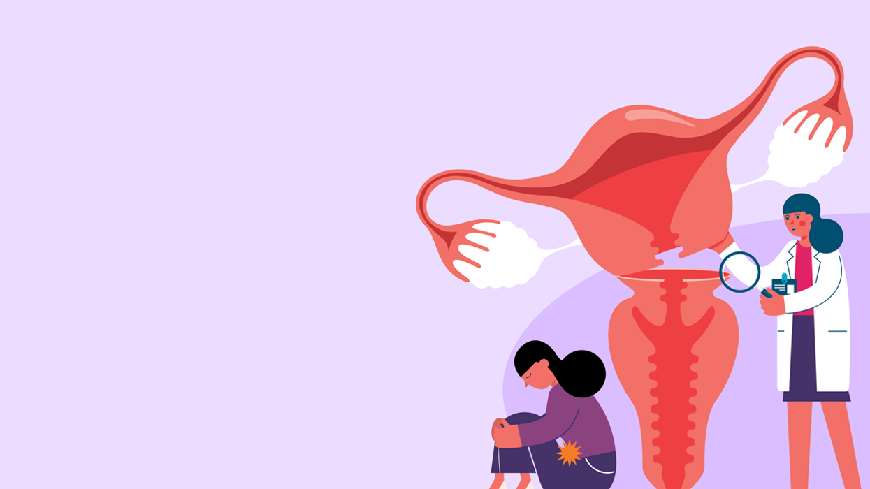 Opciones quirúrgicas para fibromas