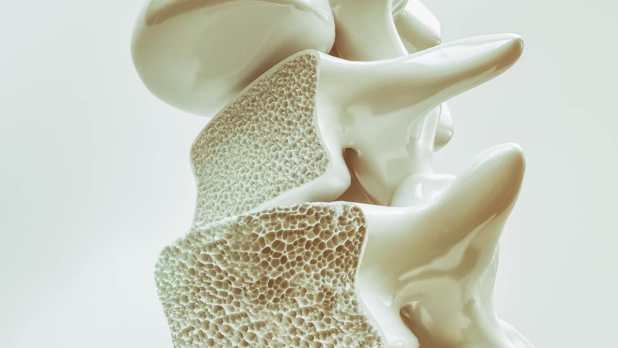 My Family’s History With Osteoporosis Changed My Medical Career Path