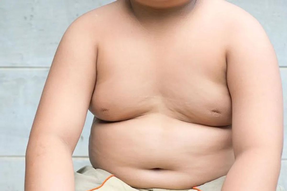overweight children