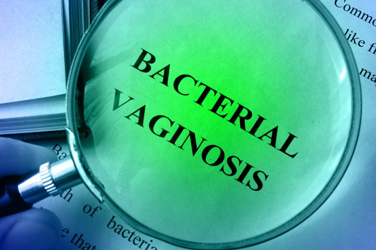 Bacterial Vaginosis 101