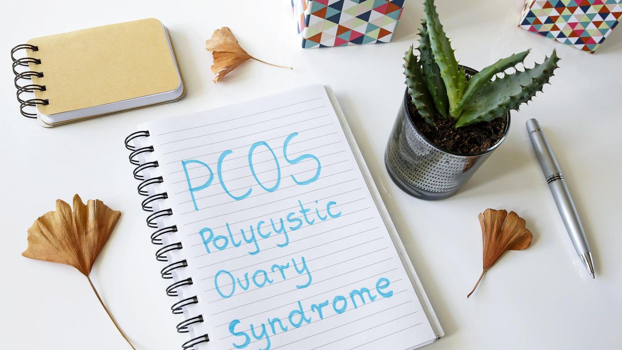 PCOS Polycystic ovary syndrome written in a notebook