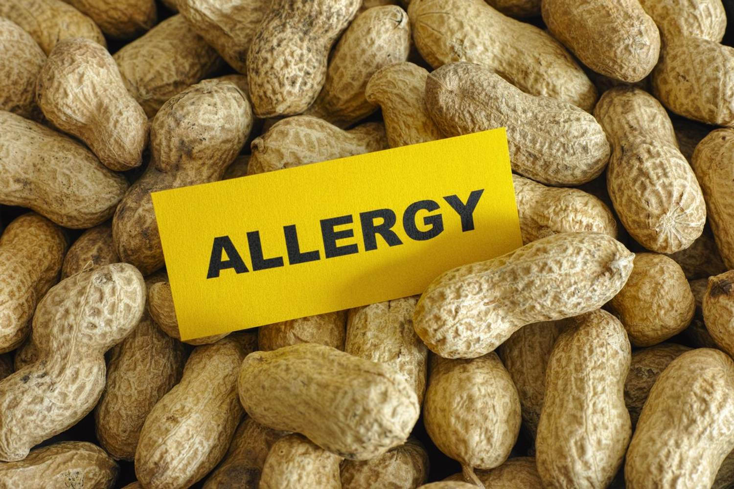 My Son Has a Peanut Allergy