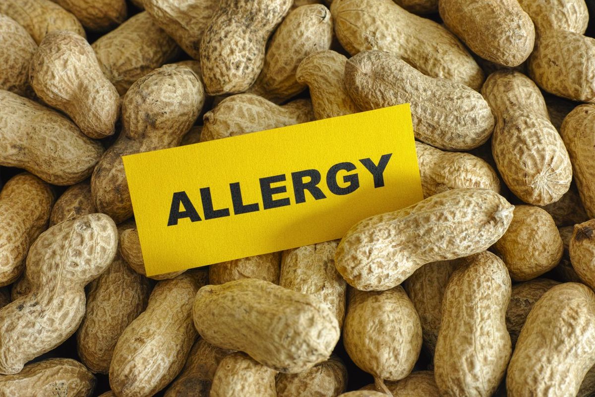 Peanut allergy concept