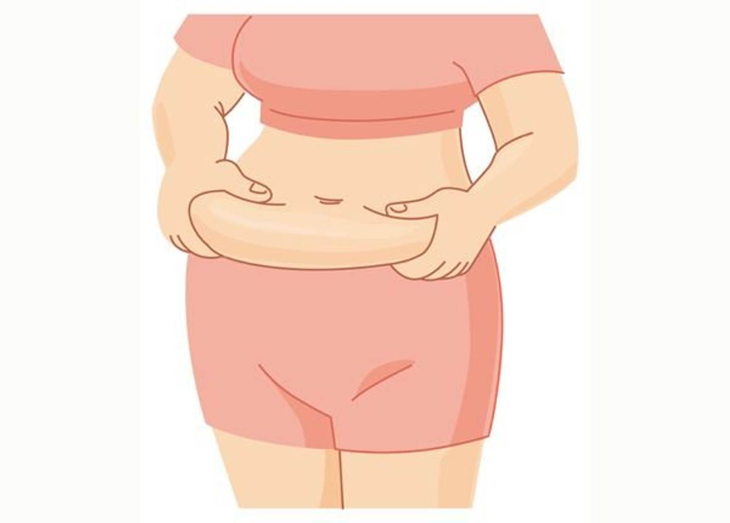 Weight Should Guide Liposuction Limits on Fat Removal